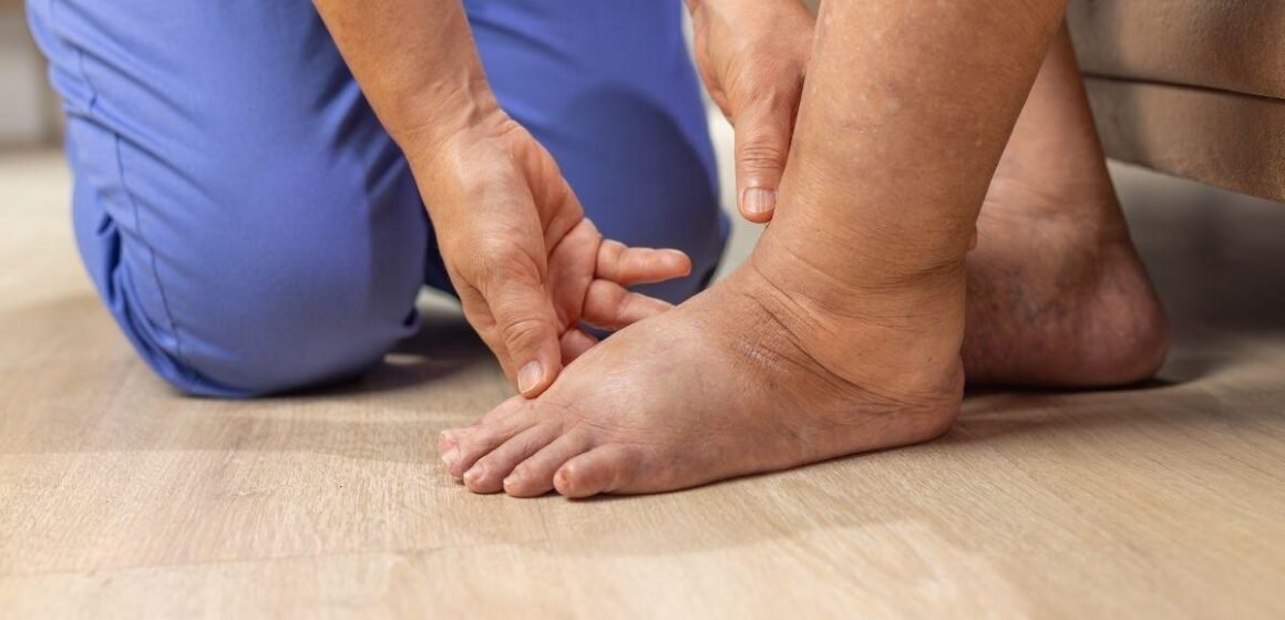Diabetic Wound Care Phoenix: 7 Essential Tips for Better Healing