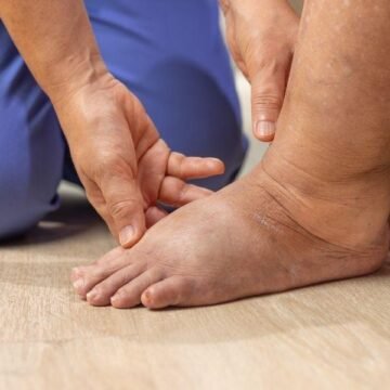 Diabetic Wound Care Phoenix: 7 Essential Tips for Better Healing