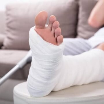 Phoenix Leg Pain Treatment | Causes, Symptoms & Best Treatment Options