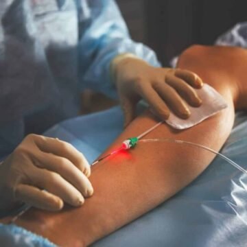 Minimally Invasive Vein Therapy 2026 Minimally Invasive Vein Treatments: The Best Solution to Varicose Veins in 2026