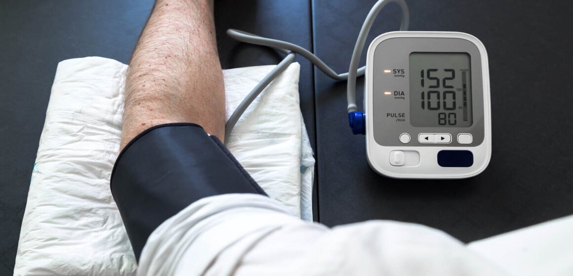 7 Tips for Dealing with Hypertension in Phoenix to Manage High Blood Pressure