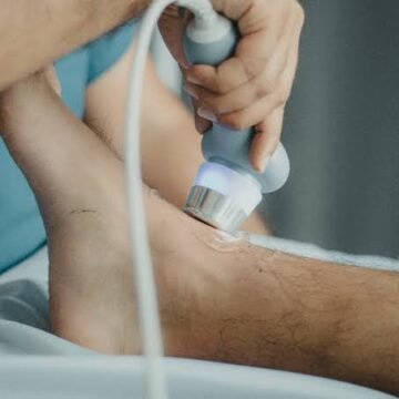 Vein Clinic Phoenix AZ: 10 Signs to See a Vein Specialist