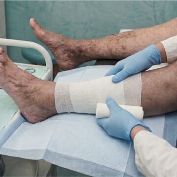 Wound Care Specialist in Phoenix?: 10 Signs That Indicate You Need to Seek Expert Wound Treatment